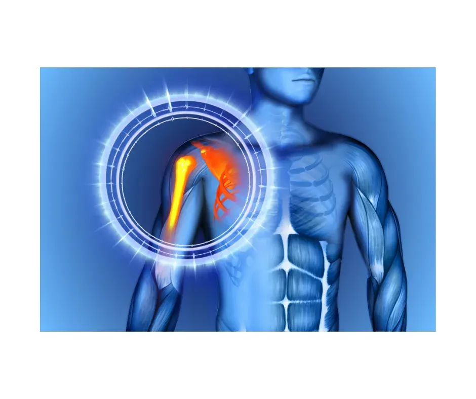 Shoulder Joint and Muscle Pain Illustration